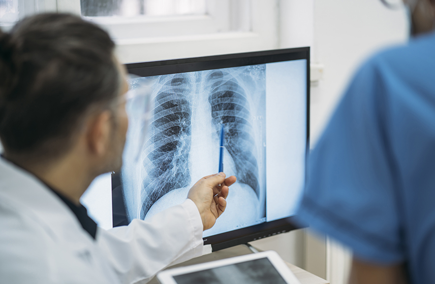 consultant looking at an X-ray of a chest