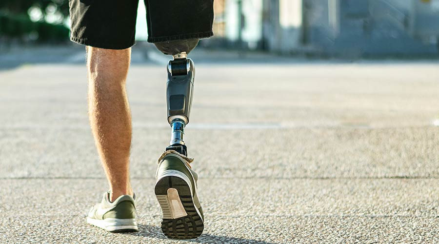 A man with a leg amputation walking outside.