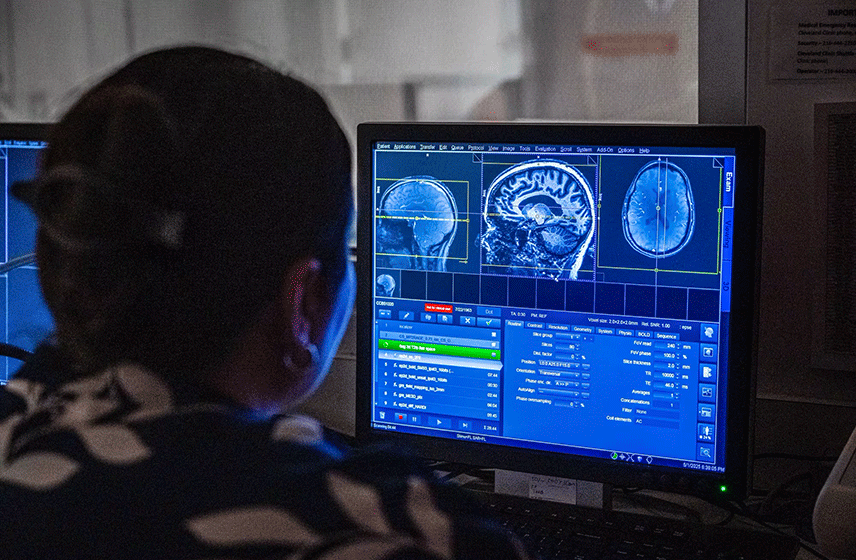 Computer monitor shows brain scans while a clinician reviews diagnostic imaging.