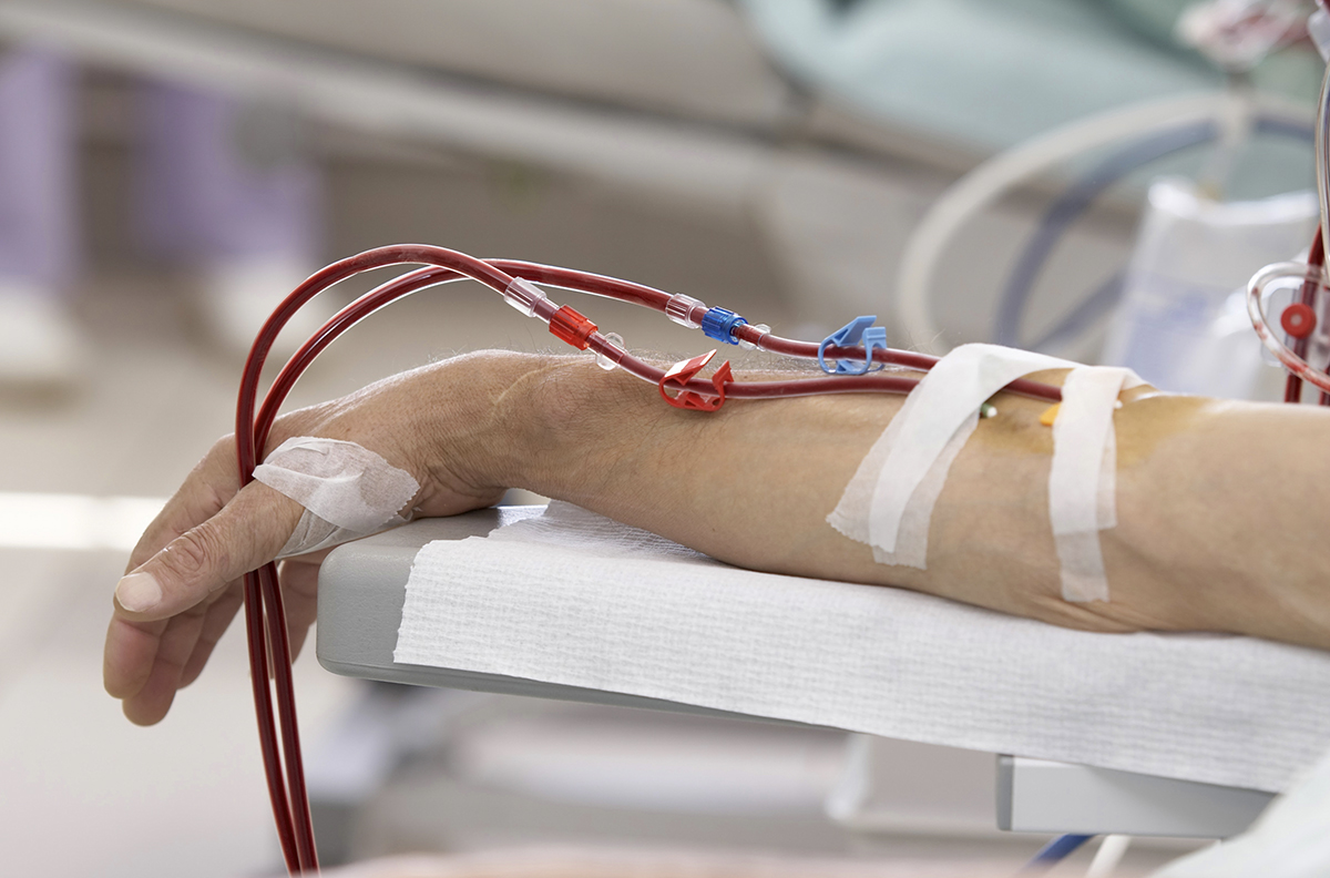 Patient receiving dialysis | Cleveland Clinic London